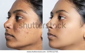 Skin Health